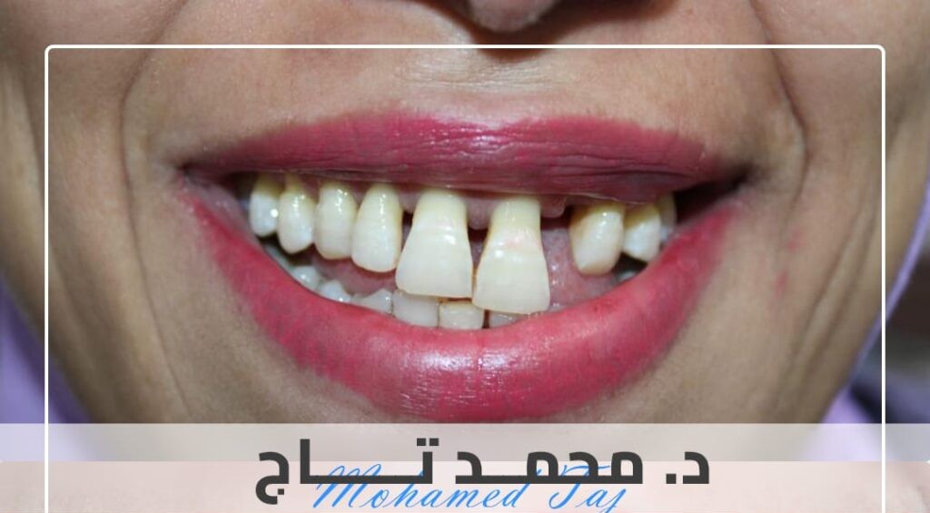 Before treatment image